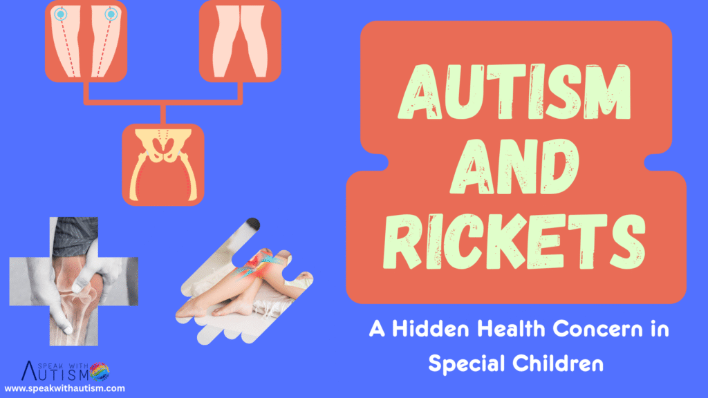 Autism and Rickets: A Hidden Health Concern in Special Children